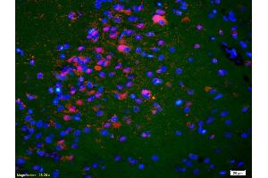Formalin-fixed and paraffin-embedded rat brain labeled with Anti-KIF5A/NKHC1 Polyclonal Antibody, Unconjugated (ABIN1387674) 1:200, overnight at 4°C, The secondary antibody was Goat Anti-Rabbit IgG, Cy3 conjugated used at 1:200 dilution for 40 minutes at 37°C. (K5A/ NKHC1 (AA 201-300) antibody)