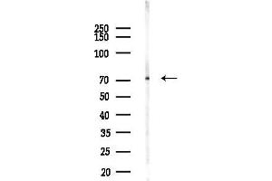 anti-DEAD (Asp-Glu-Ala-Asp) Box Polypeptide 43 (DDX43) (N-Term) antibody