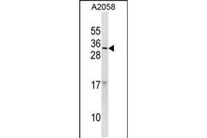 Western blot analysis in A2058 cell line lysates (35ug/lane). (RNASE9 antibody  (C-Term))