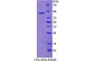 Image no. 1 for Aminolevulinate Dehydratase (ALAD) (AA 1-330) protein (His tag) (ABIN6237781) (ALAD Protein (AA 1-330) (His tag))