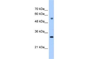 WB Suggested Anti-TTC5 Antibody Titration:  0. (TTC5 antibody  (C-Term))