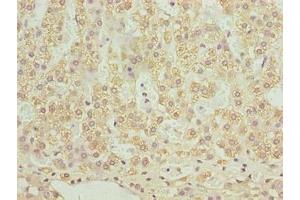 Immunohistochemistry of paraffin-embedded human adrenal gland tissue using ABIN7170079 at dilution of 1:100 (SLC12A4 antibody  (AA 601-900))