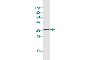 Western Blot detection against Immunogen (36. (S100P antibody  (AA 1-95))