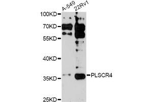 Western blot analysis of extracts of various cell lines, using PLSCR4 antibody (ABIN6291579) at 1:3000 dilution.