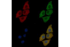YTHDF3 Mouse Monoclonal Antibody staining Hela cells by IF/ICC.