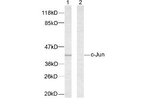 Western blot analysis of extracts from NIH/3T3 cells treated with UV. (C-JUN antibody  (Ser63))