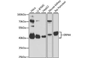 Western blot analysis of extracts of various cell lines, using ERP44 antibody (ABIN1679753, ABIN3019013, ABIN3019014 and ABIN6220673) at 1:3000 dilution. (ERP44 antibody  (AA 57-406))