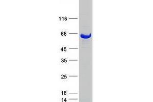 Validation with Western Blot