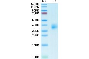 Mouse TSLPR on Tris-Bis PAGE under reduced condition. (TLSPR (AA 20-232) protein (His tag))