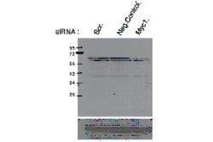 Western Blotting (WB) image for anti-Myc Proto-Oncogene protein (MYC) (pSer62) antibody (ABIN3201011) (c-MYC antibody  (pSer62))