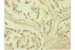 Immunohistochemistry of paraffin-embedded human prostate tissue using ABIN7161023 at dilution of 1:100 (POR antibody  (AA 2-671))