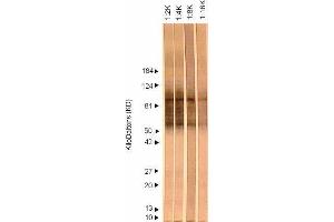 Western Blotting (WB) image for anti-Herpes Simplex Virus Type 2, Glycoprotein G (HSV2 gG) antibody (ABIN265564) (HSV-2 gG antibody)