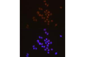 Immunofluorescence analysis of HeLa using ST Rabbit mAb (ABIN7270312) at dilution of 1:100 (40x lens).