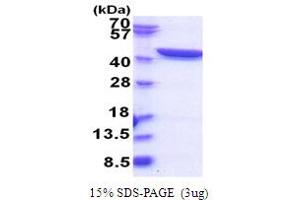 SDS-PAGE (SDS) image for Glutamine--Fructose-6-Phosphate Transaminase 1 (GFPT1) (AA 332-699) protein (His tag) (ABIN5853831)