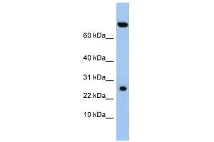 WB Suggested Anti-ZSWIM3 Antibody Titration: 0. (ZSWIM3 antibody  (N-Term))