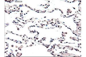 Immunohistochemical staining of paraffin-embedded lung using anti-FOXA2 (ABIN2452672) mouse monoclonal antibody. (FOXA2 antibody  (AA 300-458))