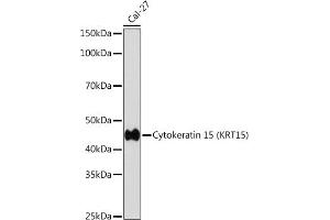 Western blot analysis of extracts of Cal-27 cells, using Cytokeratin 15 (KRT15) (KRT15) antibody (ABIN7268093) at 1:1000 dilution. (KRT15 antibody)