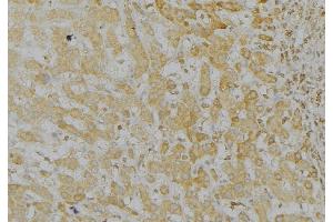 ABIN6272963 at 1/100 staining Mouse liver tissue by IHC-P. (LONP1 antibody  (C-Term))