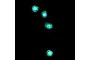 ICC/IF analysis of TLR7 in THP-1 cells line, stained with DAPI (Blue) for nucleus staining and monoclonal anti-human TLR7 antibody (1:100) with goat anti-mouse IgG-Alexa fluor 488 conjugate (Green). (TLR7 antibody)