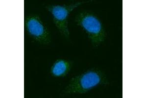 IF analysis of AGPS using anti-AGPS antibody (ABIN7600146).