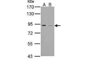 WB Image Sample (30 ug of whole cell lysate)  A: NT2D1 B:  PC-3 7. (PDE4B antibody  (C-Term))