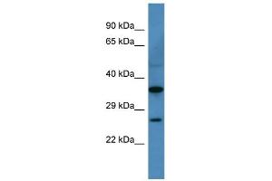 WB Suggested Anti-Cacng1 Antibody Titration: 0. (CACNG1 antibody  (N-Term))