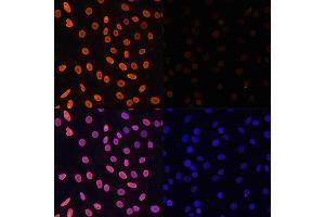 Immunofluorescence analysis of C6 cells using Acetyl-Histone H3-K36 antibody (ABIN7267671) at dilution of 1:100. (Histone 3 antibody  (H3K36))