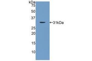 Detection of Recombinant PNMA2, Rat using Polyclonal Antibody to Paraneoplastic Antigen MA2 (PNMA2) (PNMA2 antibody  (AA 74-333))