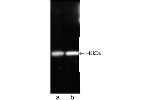 Western blot analysis of Proteasome 19S ATPase subunit Rpt6, mAb (p45-110) . (Proteasome 19S Rpt6/S8 Subunit antibody)