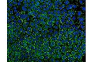 IF analysis of Tryptophan Hydroxylase/TPH1 using anti-Tryptophan Hydroxylase/TPH1 antibody (ABIN7601556). (Tryptophan Hydroxylase 1 antibody  (AA 383-444))