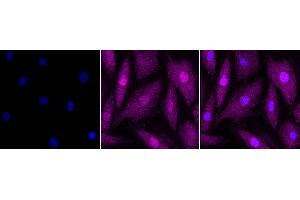 anti-RAN, Member RAS Oncogene Family (RAN) antibody