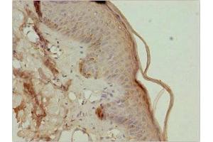 Immunohistochemistry of paraffin-embedded human skin tissue using ABIN7173433 at dilution of 1:100 (TRIM29 antibody  (AA 309-588))