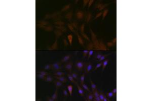 Immunofluorescence analysis of C6 cells using MEK3 Rabbit mAb (ABIN1682965, ABIN3017630, ABIN3017631 and ABIN7101512) at dilution of 1:100 (40x lens). (MAP2K3 antibody)