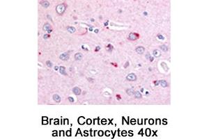 Image no. 1 for anti-Niemann-Pick Disease, Type C1 (NPC1) (C-Term) antibody (ABIN363474) (NPC1 antibody  (C-Term))