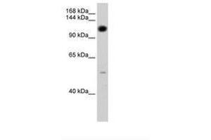 Image no. 1 for anti-Pumilio Homolog 2 (Drosophila) (PUM2) (AA 101-150) antibody (ABIN204966)
