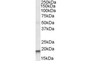 Image no. 1 for anti-Actin Related Protein 2/3 Complex, Subunit 4, 20kDa (ARPC4) (Internal Region) antibody (ABIN334353)