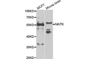 Western blot analysis of extracts of various cell lines, using MATK antibody (ABIN5974003) at 1/1000 dilution. (MATK antibody)