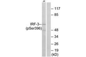Western blot analysis of extracts from Jurkat cells treated with EGF 200ng/ml 30', using IRF-3 (Phospho-Ser396) Antibody. (IRF3 antibody  (pSer396))