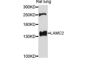 Western blot analysis of extracts of rat lung cells, using LAMC2 antibody. (LAMC2 antibody)