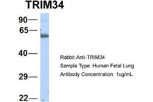 Host:  Rabbit  Target Name:  TRIM34  Sample Type:  Human Fetal Lung  Antibody Dilution:  1. (TRIM34 antibody  (N-Term))