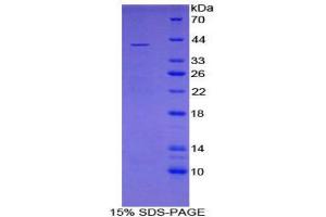 SDS-PAGE (SDS) image for Reelin (RELN) (AA 3143-3461) protein (His tag) (ABIN2123858)