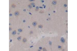 Figure. (SDHC antibody  (AA 1-72))
