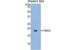 Detection of Recombinant RBP2, Mouse using Polyclonal Antibody to Retinol Binding Protein 2, Cellular (RBP2) (RBP2 antibody  (AA 1-134))