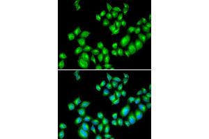 Immunofluorescence analysis of U20S cell using DRD3 antibody. (DRD3 antibody  (AA 213-329))