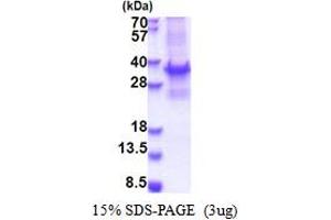 SDS-PAGE (SDS) image for Breast Cancer Metastasis Suppressor 1 (BRMS1) (AA 1-246) protein (T7 tag) (ABIN5777391) (BRMS1 Protein (AA 1-246) (T7 tag))