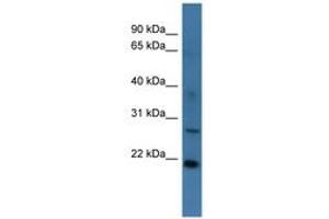 Image no. 1 for anti-StAR-Related Lipid Transfer (START) Domain Containing 4 (STARD4) (AA 96-145) antibody (ABIN6746357) (STARD4 antibody  (AA 96-145))