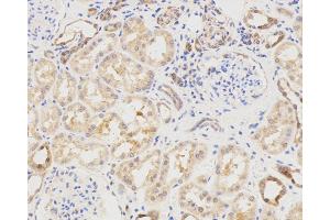 Immunohistochemistry analysis of paraffin-embedded Human spleen using LC3A/B Polyclonal Antibody at dilution of 1:500. (LC3A / LC3B antibody)