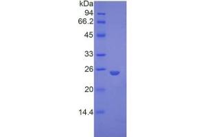 SDS-PAGE analysis of Mouse Glypican 4 Protein.
