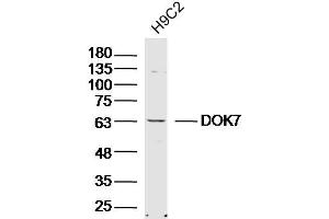 Lane 1: H9C2 lysates probed with DOK7 Polyclonal Antibody, Unconjugated  at 1:300 overnight at 4˚C.