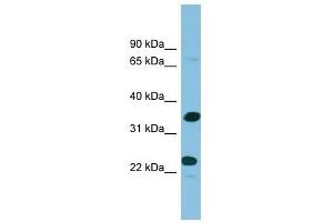 Prodynorphin antibody used at 1 ug/ml to detect target protein. (PDYN antibody  (Middle Region))